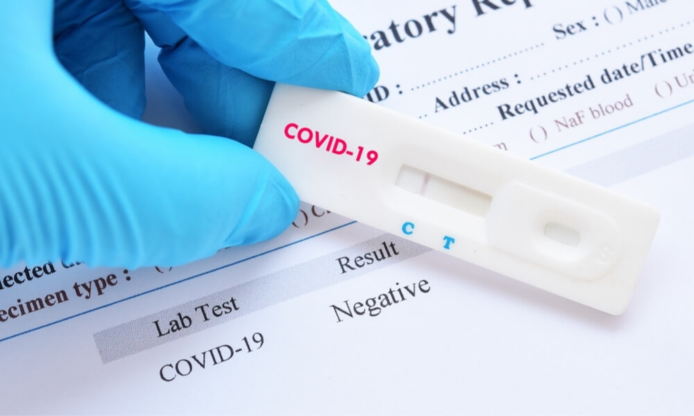 Al cierre del primer día de campaña de pruebas para detección de COVID-19, se aplicaron 2 mil 613 pruebas de antígenos.