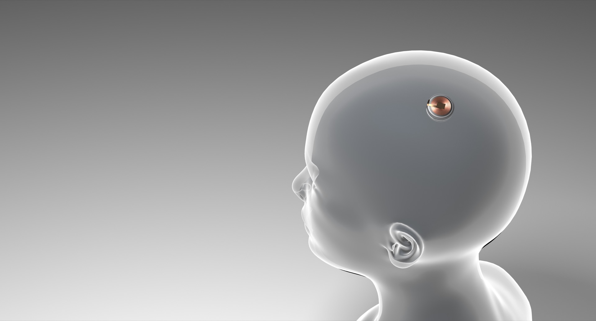 Autorizan a empresa de Elon Musk a ensayar implantes cerebrales en humanos