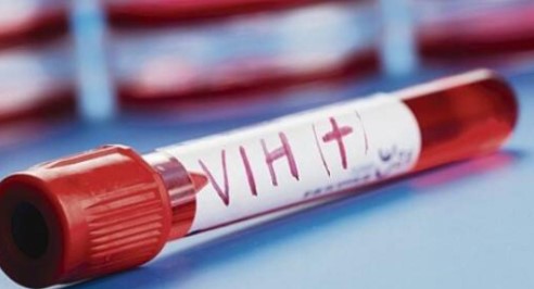 FDA autoriza vacuna preventiva contra el VIH con 99% de eficacia por 6 meses