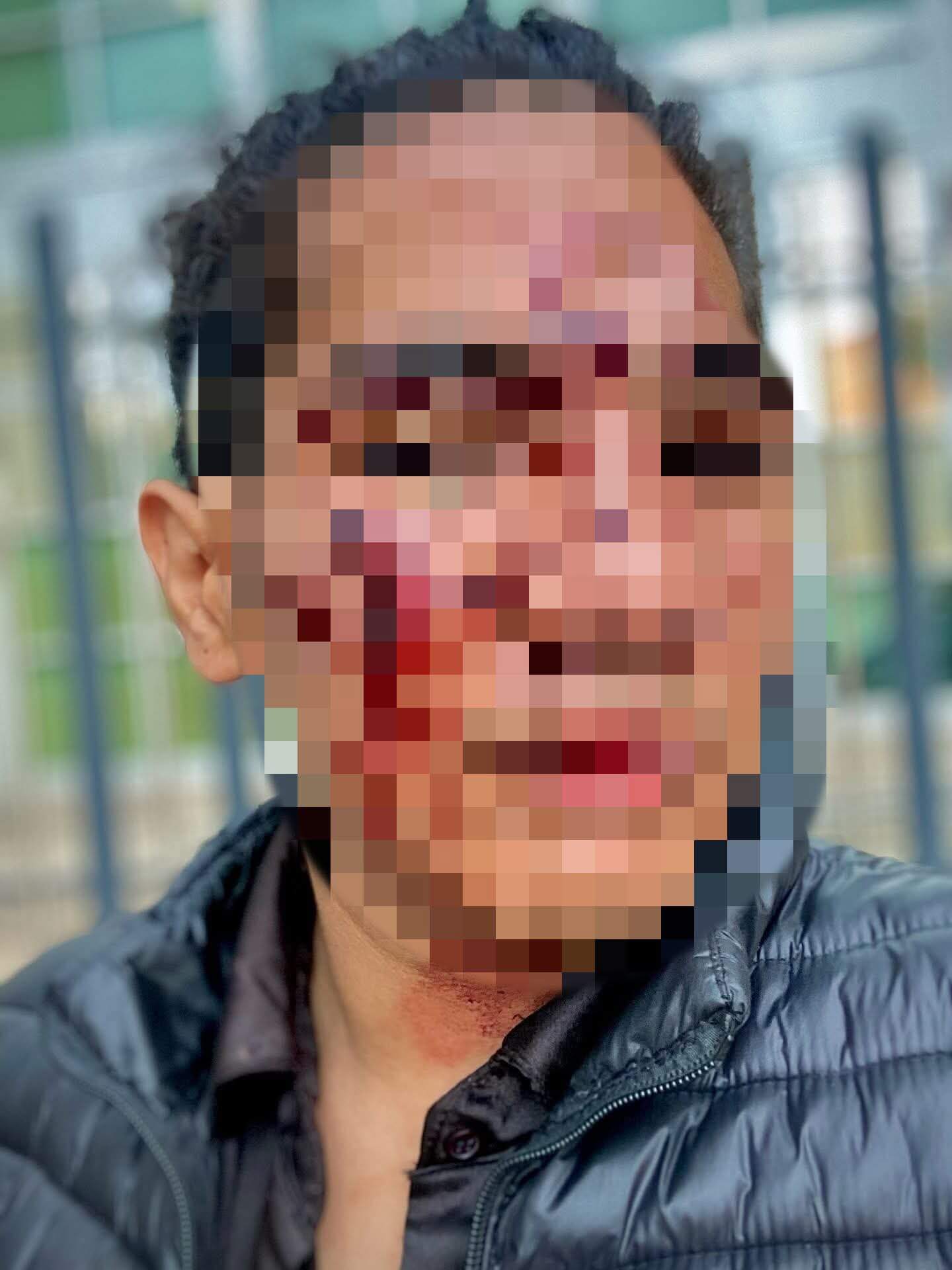 “Pude haber muerto”: joven denuncia en comunicado brutal golpiza por personal de seguridad del bar Tóxic