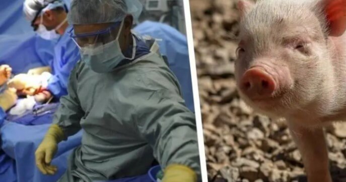 China logra trasplante de pulmón de cerdo en humano con muerte cerebral
